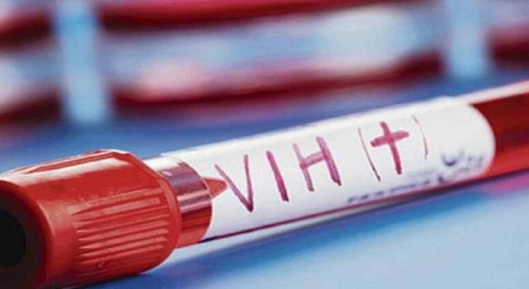 Detectan a cuatro personas con VIH en Hidalgo